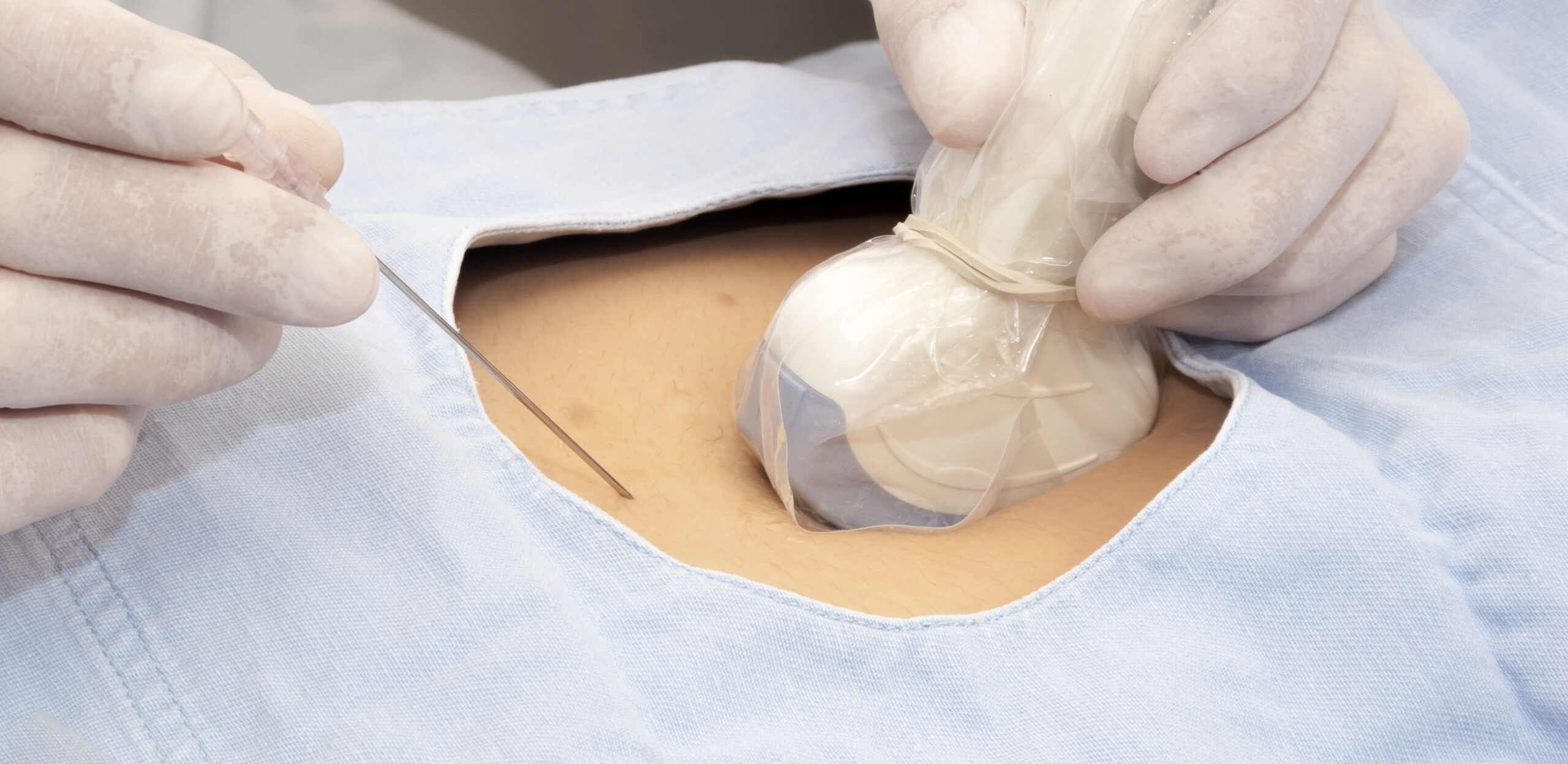 A Sonographer’s Guide to Ultrasound Guided MSK Procedures
