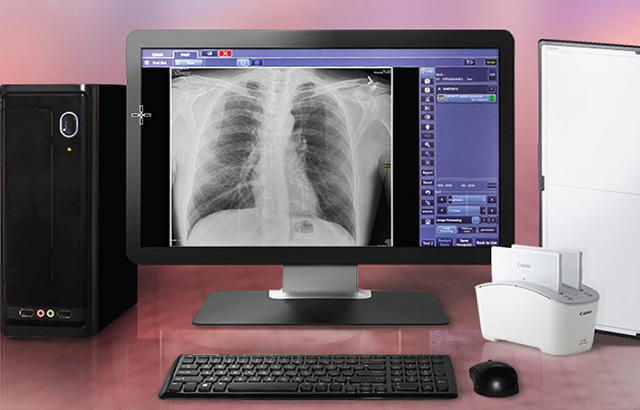 Digital Radiography - A Look at Modern Radiography