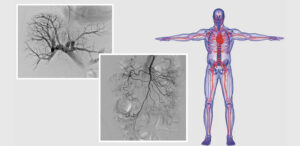 Imaging Techniques in Interventional Radiology
